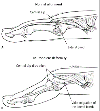 boutonniere